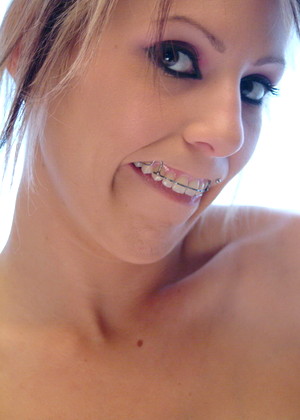 Beautyandbraces Model