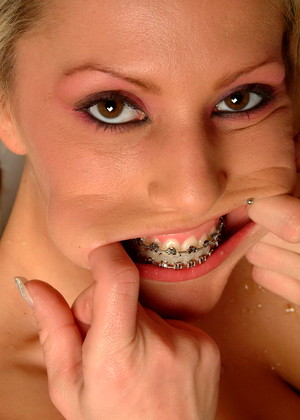 Beautyandbraces Model